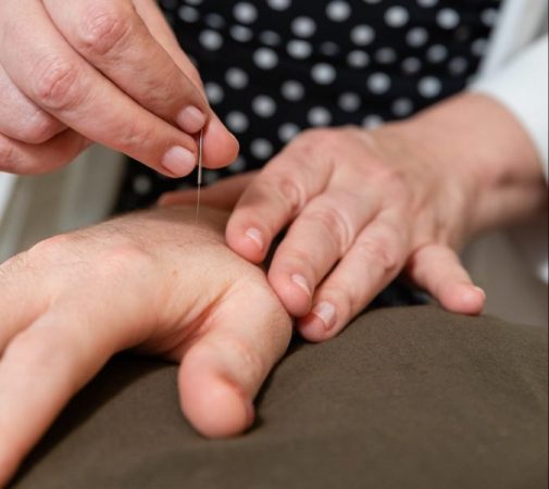 Kymberlie Landgraf Lac applies an acupuncture needle